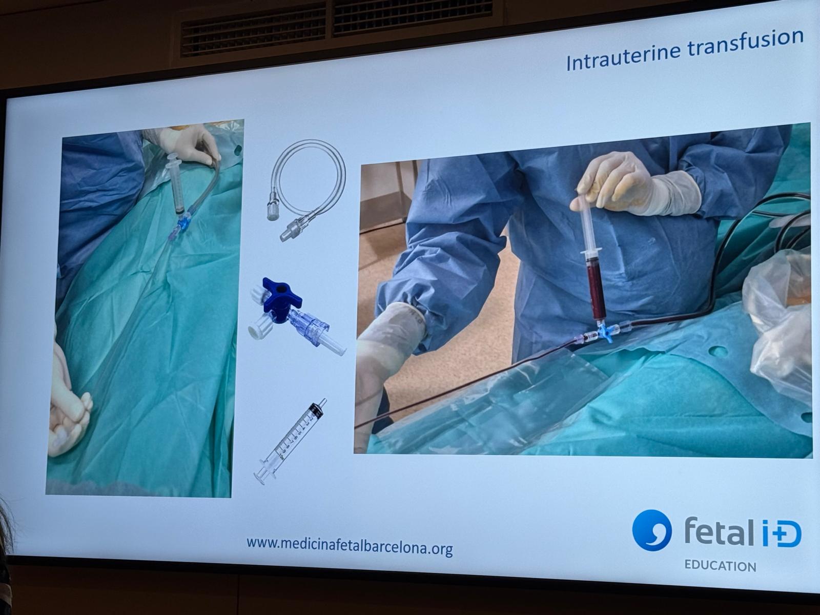 Prezentare despre transfuzia intrauterină