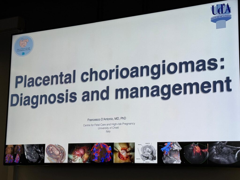 Prezentare despre corioangioamele placentare
